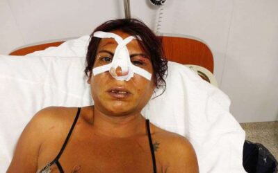 Un cliente golpeó e intentó matar a una travesti