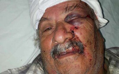 Entraron a la casa y lo despertaron a golpes para robarle la jubilación