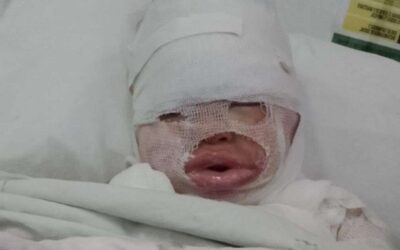 Graciela, la mamá de la nena que fue quemada con aceite hirviendo pidió que la empleada vaya a declarar